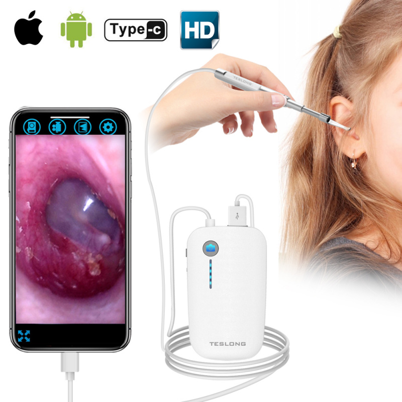 Teslong NTE100I iPhone/Android Otoscope